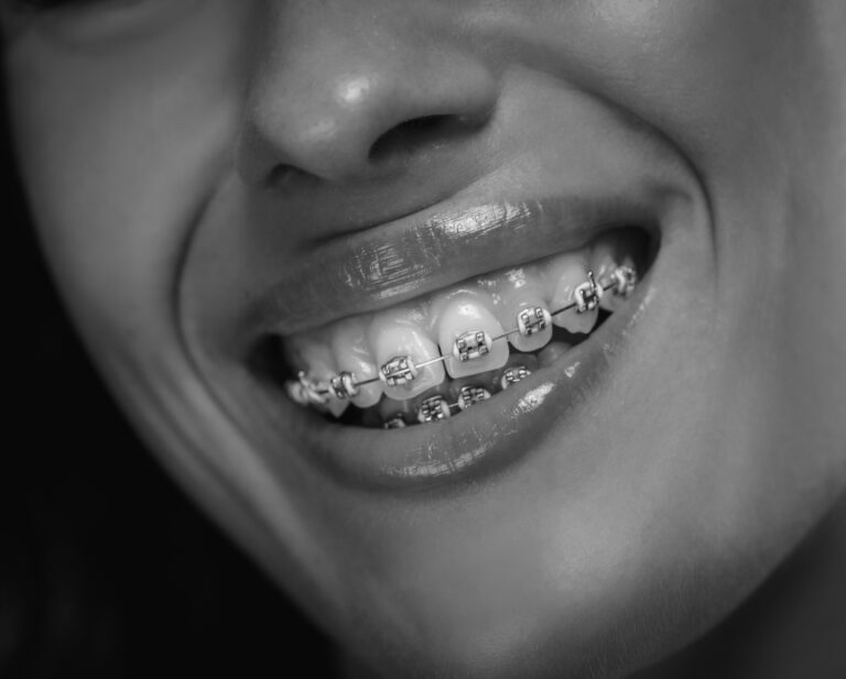 woman smiling wearing braces